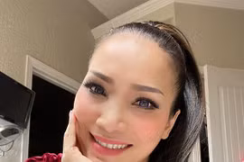 Hồng Ngọc tự tin khoe cận khuôn mặt rạng rỡ sau sự cố nổ nồi xông hơi