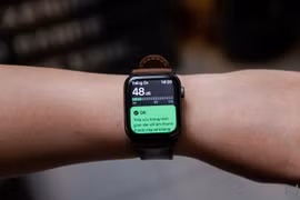 Apple Watch đứng ngôi đầu, bỏ xa đối thủ đứng vị trí thứ hai
