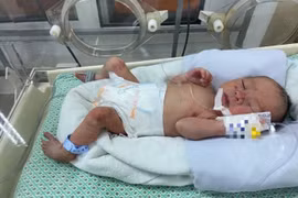 Hà Nội: Bé sơ sinh bị bỏ rơi giữa khe tường đã qua cơn nguy kịch