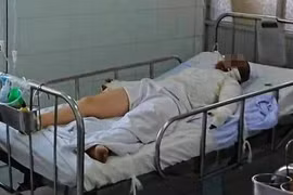Hà Nam: Đốt pháo tự chế một người bị thương nặng