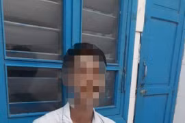 Hy hữu: Cứu sống thần kỳ bệnh nhân ngưng tim giãn đồng tử vì điện giật