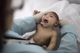 Việt Nam đối mặt với nguy cơ lây lan virus Zika 'ăn não người'