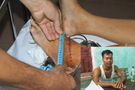 Bản tin pháp luật 8H: Chém đứt gân công an viên rồi cố thủ trong nhà