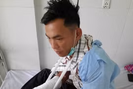 Kon Tum: Cán bộ bảo vệ rừng của Công ty lâm nghiệp Ia H’drai liên tiếp bị hành hung