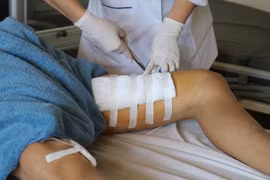 Dùng hai chân kẹp bình rượu 20 lít, người đàn ông bị đứt cơ chân