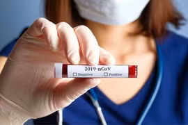 TP. HCM: Gần 1/10 mẫu xét nghiệm COVID-19 những người về từ Đà Nẵng có kết quả âm tính