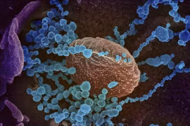Mã gien virus SARS-CoV-2 gây bệnh ở Hải Dương và Đà Nẵng giống nhau