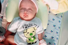 Mổ tách cặp song sinh dính liền Trúc Nhi - Diệu Nhi phức tạp ra sao?