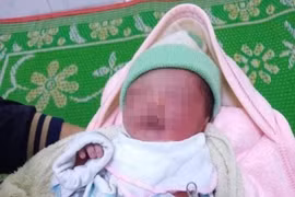 Bé gái sơ sinh bỏng nặng vì bị bỏ rơi trong rẫy giữa trời nắng nóng