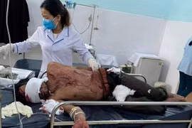 Thông tin mới nhất vụ người đàn ông bị gấu rừng tấn công ở Quảng Nam
