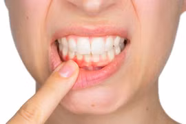 Những dấu hiệu bệnh răng miệng cho thấy sức khỏe bạn đang gặp vấn đề