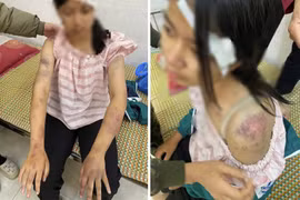 Xác minh, làm rõ việc bé gái 13 tuổi bị ông bà bạo hành đến mức nhập viện cấp cứu