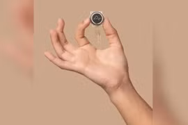 Người đàn ông mắc ALS có thể nói trở lại nhờ cấy ghép não Neuralink