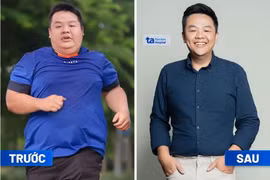 Thoát “bụng bia” nhờ giảm cân chuẩn y khoa