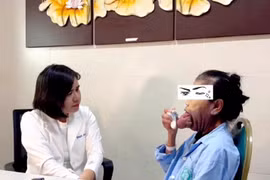 Người phụ nữ hơn 70 năm khổ sở vì dị tật lưỡi khổng lồ, được ‘giải thoát’ sau ca phẫu thuật