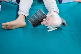 Bị thang cuốn kẹp vào chân, bé trai Hà Nội phải mổ cấp cứu