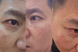 Hiệu trưởng và giáo viên ẩu đả trong tiệc 20/11, chính quyền vào cuộc xác minh