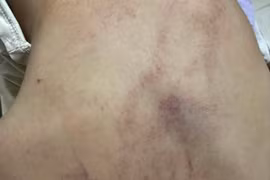 Hà Nội: Khẩn trương làm rõ vụ trẻ mầm non nghi bị bạo hành