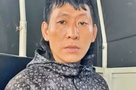 Anh trai bị người tình của em gái chém vào mặt gây thương tích nặng