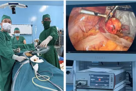 Không cần ra đất liền, bệnh nhân Côn Đảo được mổ nội soi ngay tại đảo