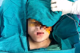 9 giờ phẫu thuật miễn phí cứu thiếu nữ Mông mang khối u khổng lồ