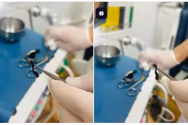 Phát hiện đỉa rừng trong mũi cháu bé hơn 2 tuổi