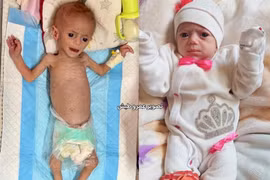 Bức ảnh gây chấn động thế giới: Câu chuyện đằng sau em bé Siwar Ashour ở Gaza