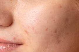 Thu hồi, tiêu hủy hàng loạt mỹ phẩm Image Skincare vì vi phạm nghiêm trọng nhãn mác, công thức