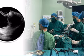 Suýt mất khả năng làm mẹ vì khối u hiếm gặp
