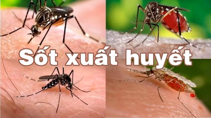 Hiện nay dịch sốt xuất huyết đang có chiều hướng gia tăng (ảnh nguồn internet).
