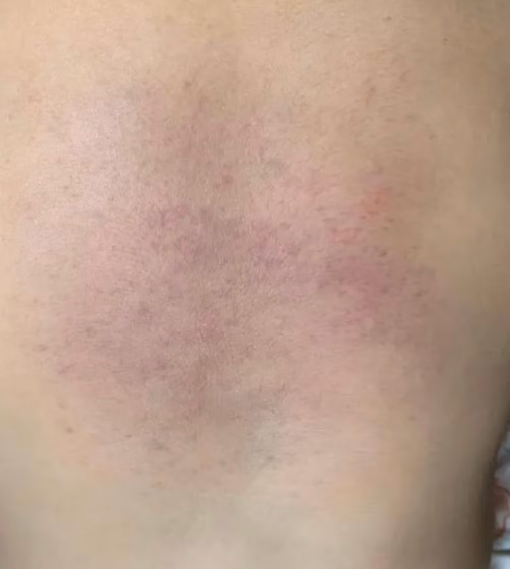 xac minh vu chau be nghi bi bao hanh o nhom giu tre tai binh thuan hinh 1
