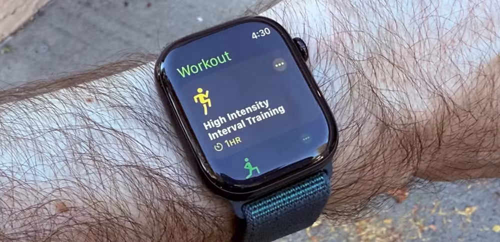 galaxy watch 7 vs apple watch series 10 cuoc doi dau dinh cao dong ho thong minh hinh 4