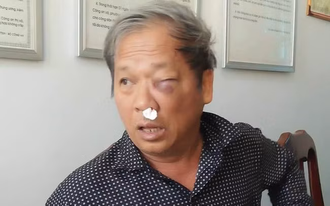 Nhà báo Hoàng Đình Chiểu bị hành hung dẫn tới nhiều thương tích. Ảnh: VTV