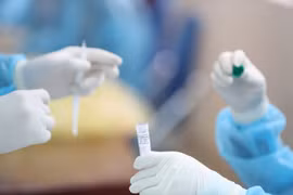 Hà Nội: Thêm ca dương tính với SARS-CoV-2 thứ 15
