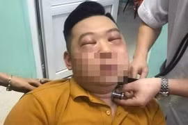 Thái hành, nam thanh niên ở Phú Thọ bị sốc phản vệ