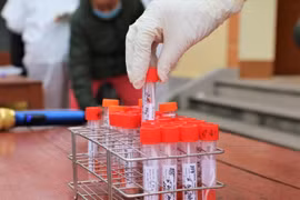 Hà Nội: Xét nghiệm SARS-CoV-2 cho công dân trước khi nhập ngũ
