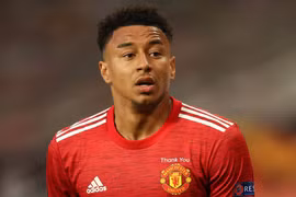 Jesse Lingard dương tính với Covid-19