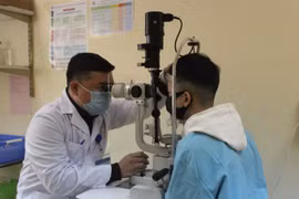 Chuyên gia cảnh báo tai nạn về mắt do chơi pháo tăng cao