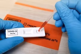 Bộ Y tế: Xét nghiệm để định lượng kháng thể là không cần thiết