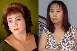 Nghệ sĩ Hoàng Lan sức khỏe yếu, cột sống bị hoại tử