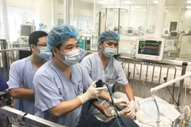 Sặc hạt điều, một bé trai 2 tuổi nguy kịch đến tính mạng