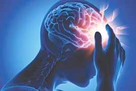Những dấu hiệu sắp đột quỵ bạn nên biết