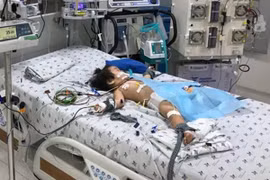 TP. HCM: Cứu bé gái 15 tháng tuổi mắc bệnh chân tay miệng biến chứng nặng