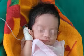 Nghệ An: Phẫu thuật thành công cho bé sơ sinh có đường ruột nằm ngoài ổ bụng