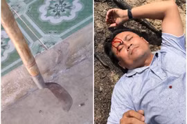 Luật sư kiến nghị trả hồ sơ điều tra lại "vụ án dượng chém cháu ở Tây Sơn - Bình Định"