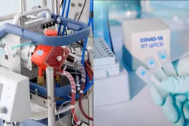 Tập đoàn Masan ủng hộ 2 máy ECMO và 6.000 kit xét nghiệm tới TP. HCM