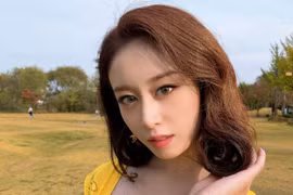 Jiyeon (T-ara) bị sốc vì liên tục nhận tin nhắn đe dọa