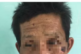 Đã bắt được nghi phạm gây cháy chi nhánh ngân hàng ở Kiên Giang