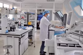 Các Bộ, ngành, địa phương quyết định hình thức lựa chọn nhà thầu mua sắm phục vụ phòng, chống dịch COVID-19