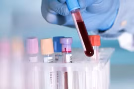 Hưng Yên: Xét nghiệm hơn 1000 trường hợp liên quan đến 3 ca dương tính SARS-CoV-2